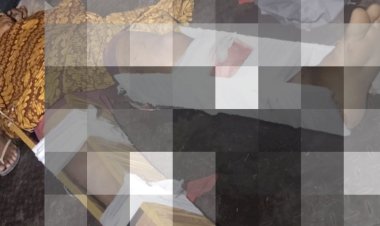 Lakalantas di Dodaek Satu Orang Patah  Kaki dan Dua Lainnya Luka Luka