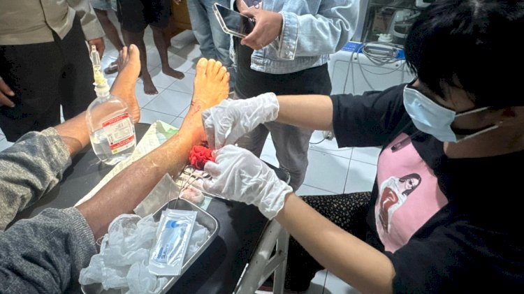 Motor Vs Motor, Salah Satu Pengendara Alami Luka dan Patah Kaki Kiri